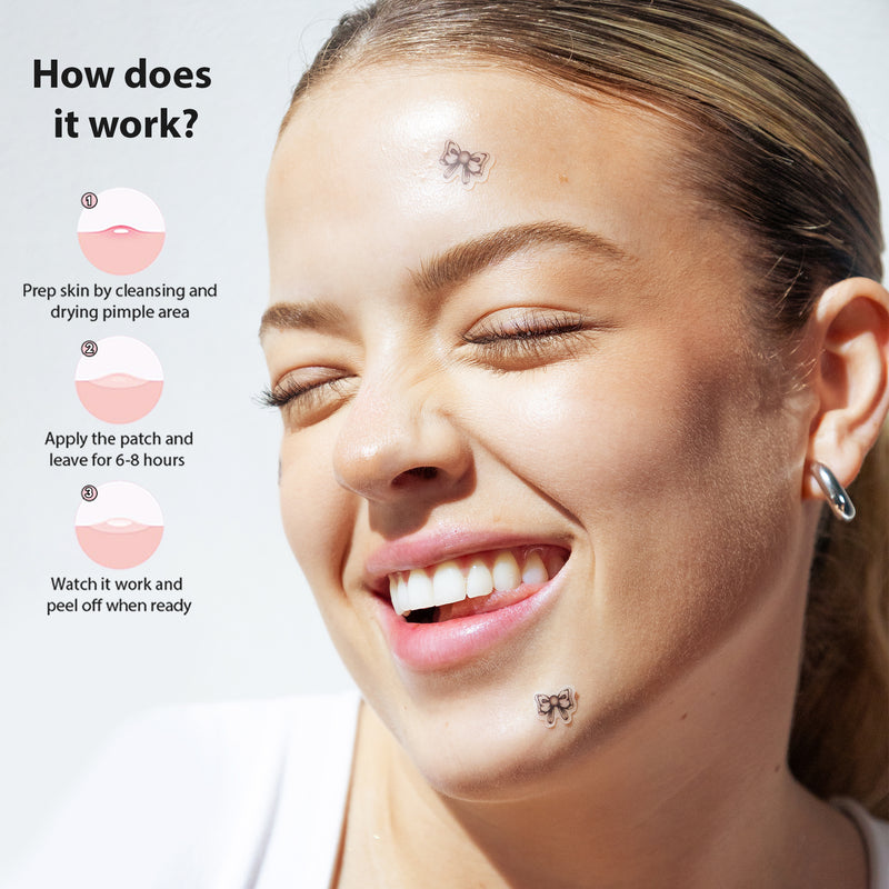 Knot Now Pimple Patches | 18 Black & White Bows